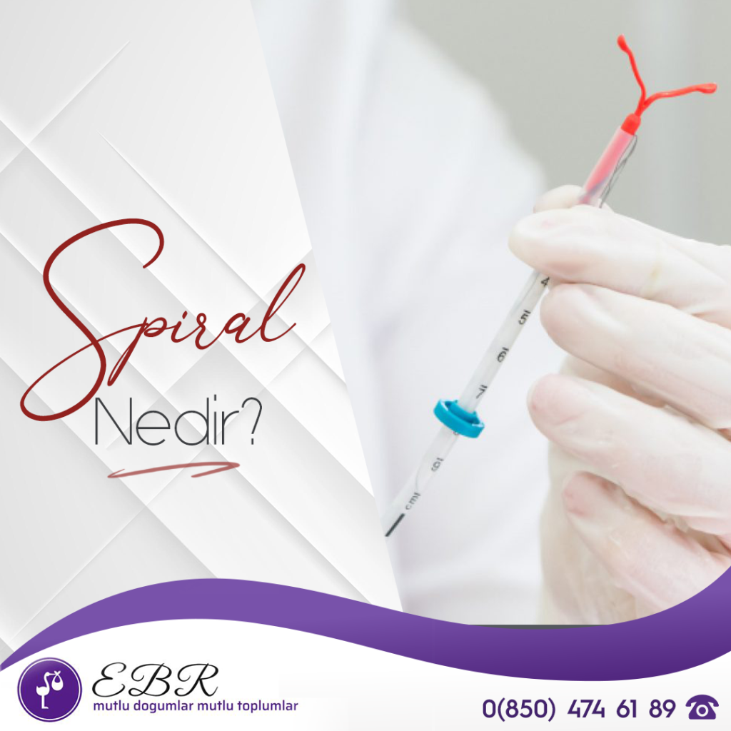 spiral nedir
